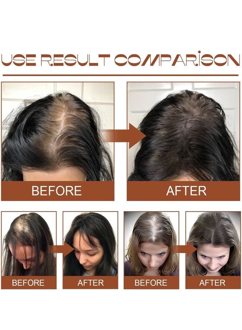 EELHOE Batana Oil for Hair Growth – Organic Hair Repair Oil for Fuller, Healthier & Revitalized Hair - Image 3