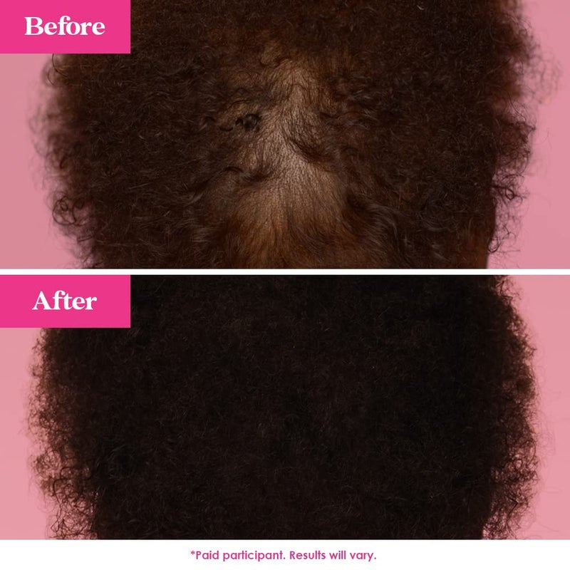 Grande Cosmetics GrandeHAIR Enhancing Hair Serum - for Men & Women, for Fuller & Thicker-Looking Hair in 8 weeks, Safe for Color-Treated Hair (40 mL) - Image 5