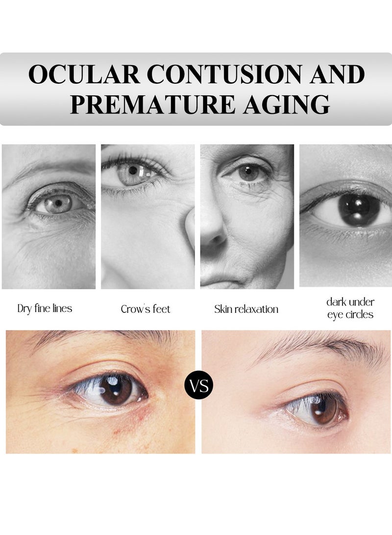 EELHOE Eye Repair Cream，Eye Cream，Eye Enhancing Roller 20 ml, Anti-Aging Under Eye Roller Cream for Dark Circles Puffiness Wrinkles and Fine Lines, Eye Care Serum with 360°Massage Ball,Relieve Eye Fatigue Lift Firm Reduce Wrinkles - Image 4