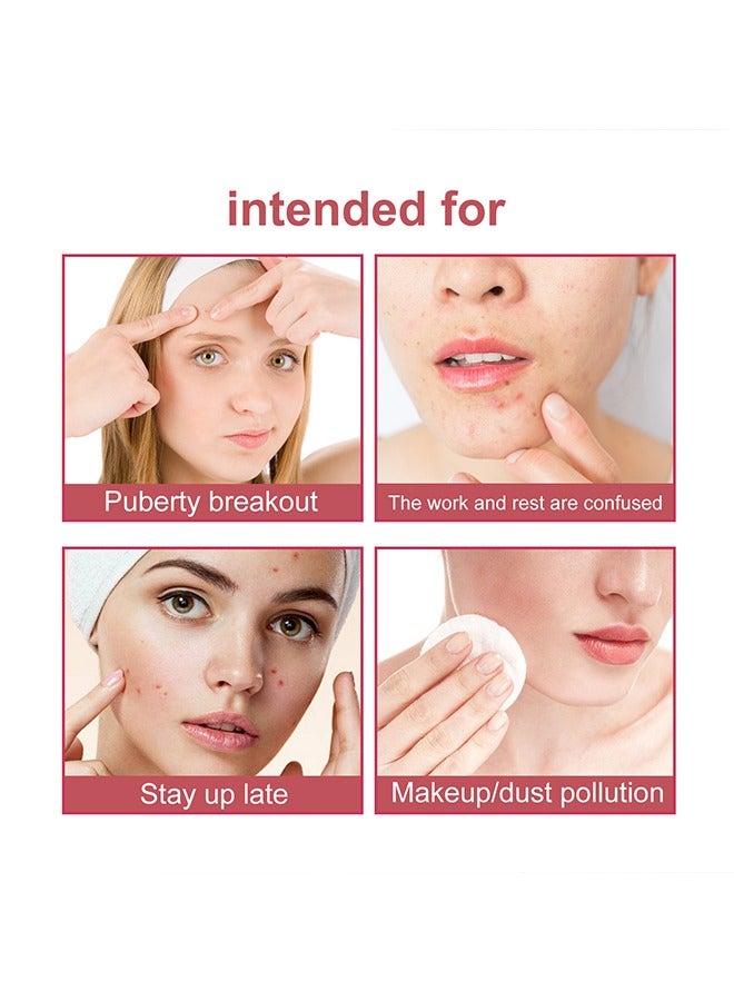 wiieey 144Pcs Pimple Patches for Face,Hydrocolloid Acne Patches for Covering Zits and Blemishes, Cute Spot Stickers for Skin Care - Image 5