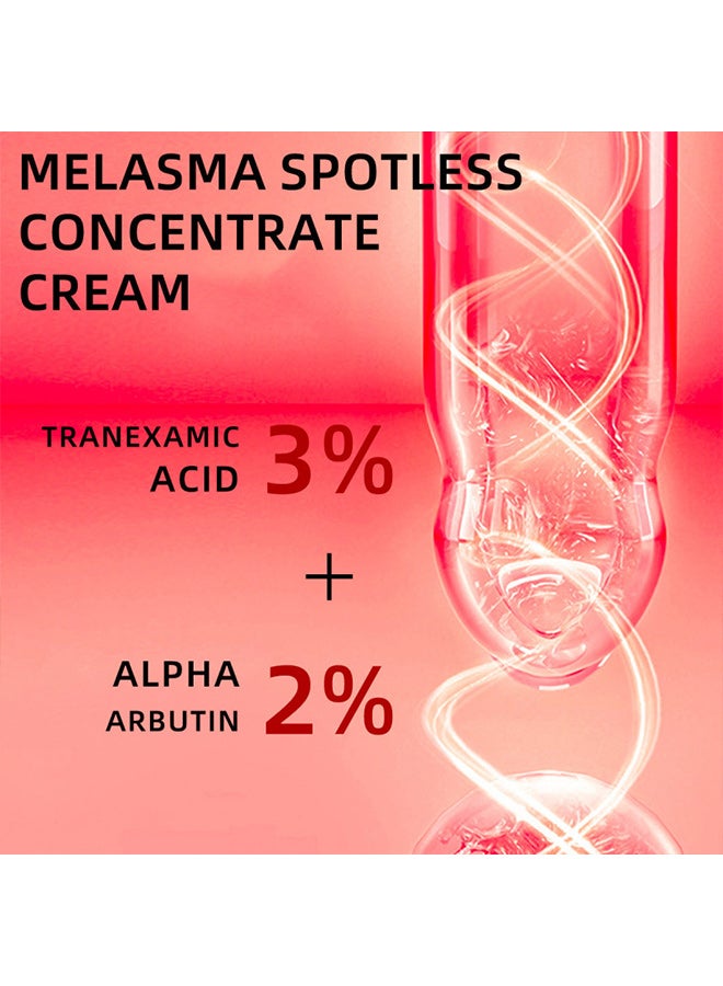 BARUBT Melasma Whitening Concentrate, Spot Remover Cream Lightens Spots, Brightens and Diminishes Spots, Melasma and Freckles - Image 3