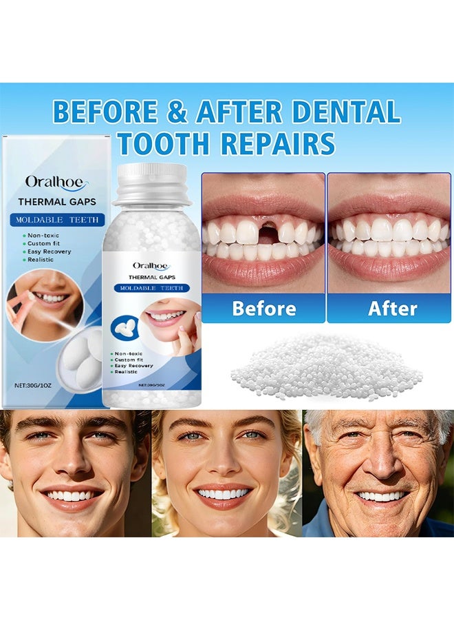 ORALHOE Tooth Repair Kit, Moldable Tooth Filling Repair Kit, Temporary Tooth Repair Kit, Dental Care Kit Fixing The Missing And Broken Replacements, DIY Natural Filling Fake Teeth, Smile Confidently Again - Image 4