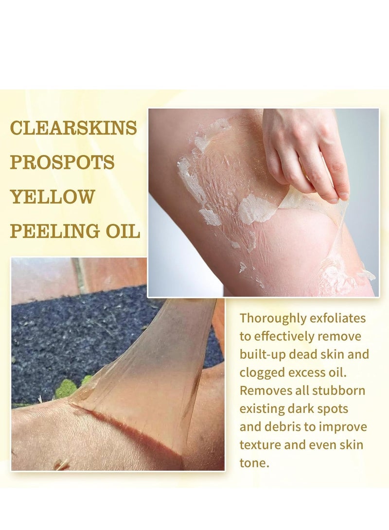 EELHOE Super Strength Yellow Peeling Oil for Face & Body Dark Spots, Natural Skin Peeling Oil for Skin Whitening & Brightening, Deep Exfoliation for Smooth Skin 50ml - Image 4