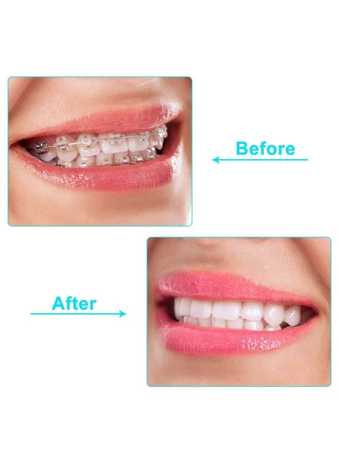 6 pcs aligner chews, medical grade silicone orthodontic chews, aligner tray seat chews, for Invisalign aligners, mint color, strawberry flavor, original, free carrying case, suitable for travel and storage - Image 4