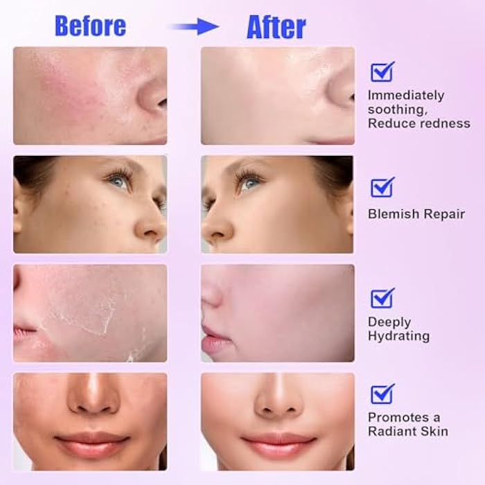Kewhunt Madecassoside Sheet Mask Blemish Repair, Face Mask korean Skin Care for Sensitive Skin - Hyaluronic Acid, Collagen, Niacinamide, Panthenol, Centella Facial Masks for Sooth, Hydration, Firming 10ea - Image 4