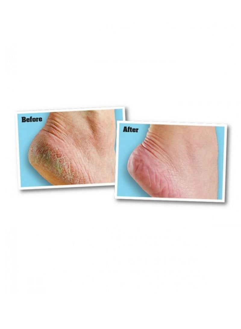 O'Keeffe's O'Keeffe Healthy Feet Foot Cream 76g - Image 2