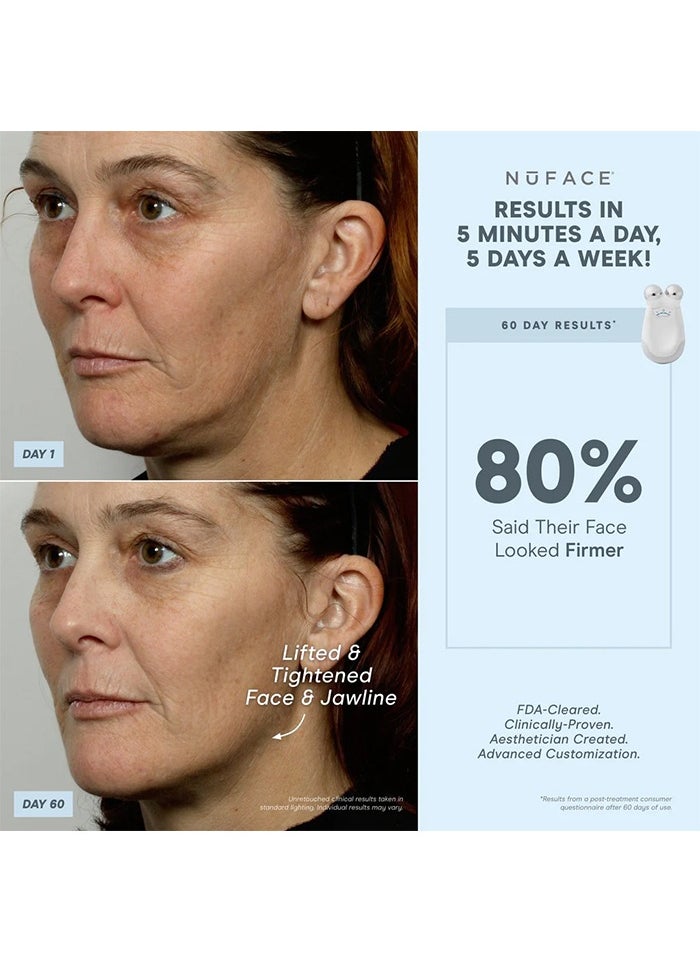 Nuface - NUFACE Trinity Pro Facial Toning Device includes 2oz/59 ml Gel Primer - White - Image 1