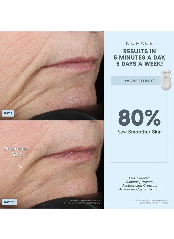 Nuface - NUFACE Trinity Pro Facial Toning Device includes 2oz/59 ml Gel Primer - White - Image 1