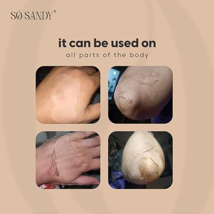 So Sandy Mela Off Cole Peel Cream with whitening Effect, 15 g - Image 4