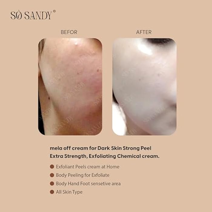 So Sandy Mela Off Cole Peel Cream with whitening Effect, 15 g - Image 3
