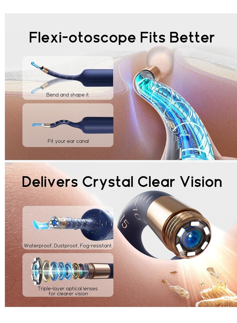 Bebird Earsight Plus R37R Ear Cleaning Camera Wax Removal Tool kit, Flexible Ear Scope Otoscope Camera Light, Visual Ear Picker Wireless Earwax Remover Tweezers for Adults & Kids - Image 3