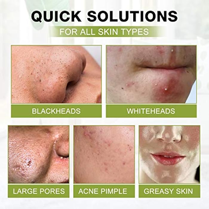 SHVYOG Blackhead Peel Off Face Mask, 3-in-1 Blackhead Remover Mask with Brush & Tea Tree Oil Serum, Charcoal Mask for Deep Cleansing Dirts, Pores, Skin Oil (100g+30ml) - Image 5