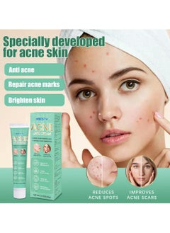 HBESTY Acne Care Cream，Oil Control Anti Acne Facial Care ，Acne Spot ，Cystic Acne，Fungal Acne ，Face Acne Spot Treatment and Acne Scar Treatment Post Acne Marks Treatment，Pimple Remover， Acne Repair 20g*2pcs  - Image 2