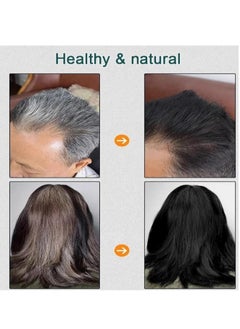 Generic 10 PACKS Natural Plant Hair Dye, Plant Fruit Hair Dye Cream, Plant Bubble Hair Dye Shampoo,instant Natural Hair Dye Shampoo, Plant Extract for Grey Hair Color Bubble Dye (Chestnut Brown)  - Image 3