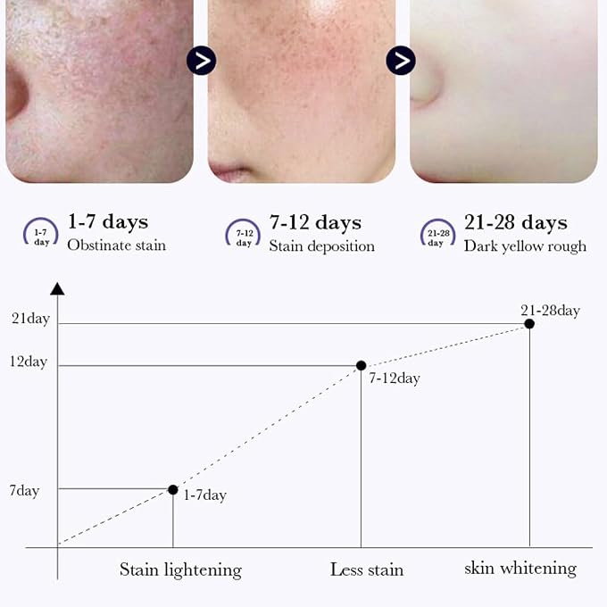paminify Dark Spot Remover for Face,Nicotinamide Whitening Freckle Cream,Skin Dullness Lightening Body Cream,Visible Results in 28 Days,Smooth Melasma,Hyperpigmentation Age Dark Spot Corrector,0.7 oz - Image 3