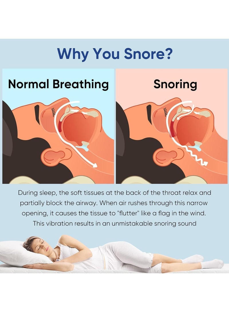 general Anti snoring device  for men and women anti snoring device for all mouth shapes  professional and reusable anti snoring mouth - Image 3