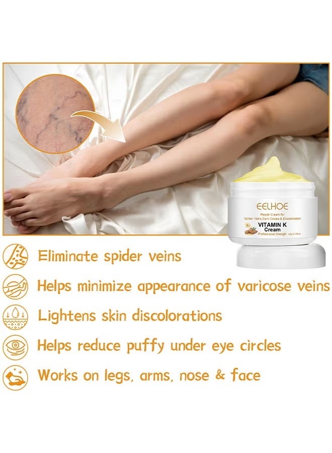 EELHOE Vitamin K Varicose Veins Cream, Soothing Leg Cream, Varicose And Spider Veins Treatment Cream, Improve Blood Circulation, Fast Relieve Swelling Pain 60G - Image 4
