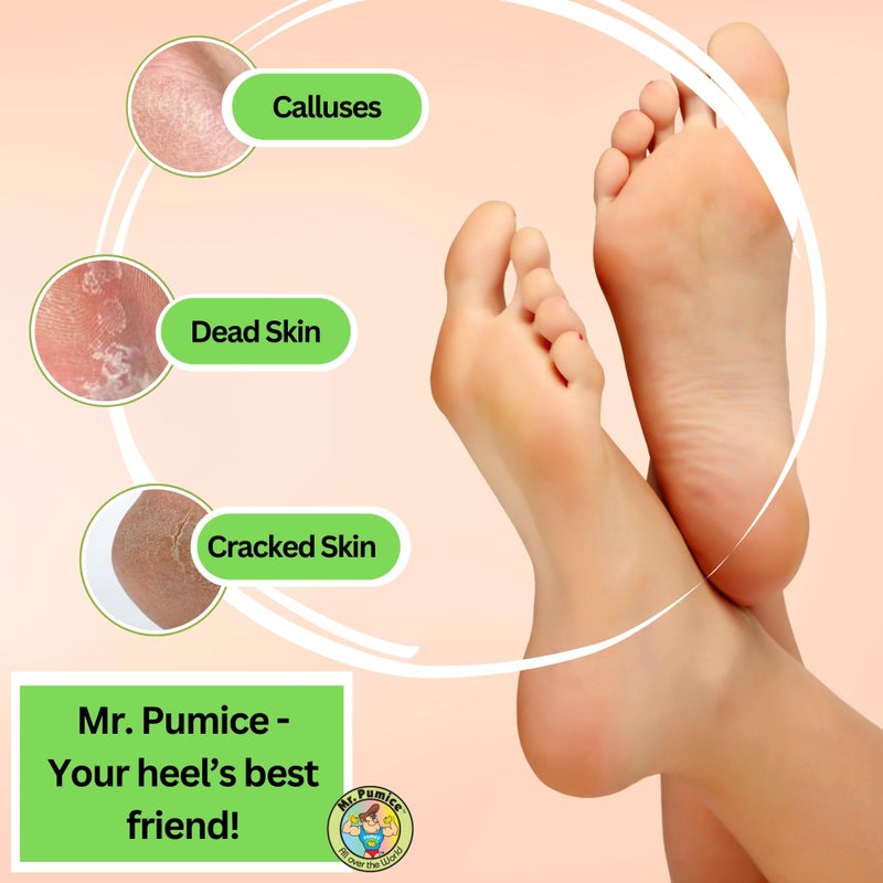 Mr. Pumice Callus Remover PUMI Bar: Pedicure Stone & Foot/Heel Scrubber - Medium Grit (Assorted Colors) 4 Pack - Image 5