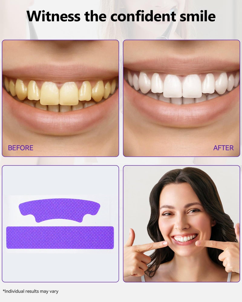Orrhomi Teeth Whitening Strips 14 Treatments, Enamel Safe for Sensitive Tooth, Whitens Teeth, Purple Whitening Strips, Removes Yellow Stains & Bad Breath - Effective Color Correction for a Brighter Smile - Image 3