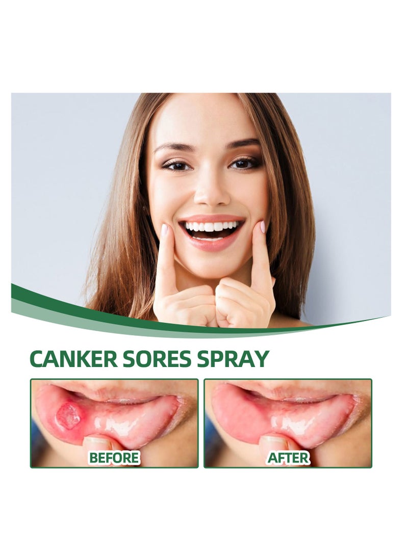 ساوث مون رذاذ قرحة الفم، رذاذ تخفيف قرحة الفم، علاج قرحة اللسان، رذاذ التنفس السيئ، علاج القرحة، معطر الفم، علاج قرحة الفم بالأعشاب، علاج فعال لقرحة الفم - Image 2