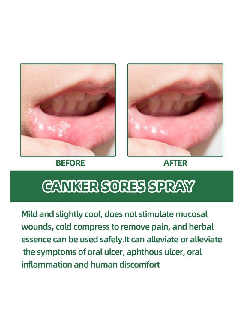 ساوث مون رذاذ قرحة الفم، رذاذ تخفيف قرحة الفم، علاج قرحة اللسان، رذاذ التنفس السيئ، علاج القرحة، معطر الفم، علاج قرحة الفم بالأعشاب، علاج فعال لقرحة الفم - Image 3