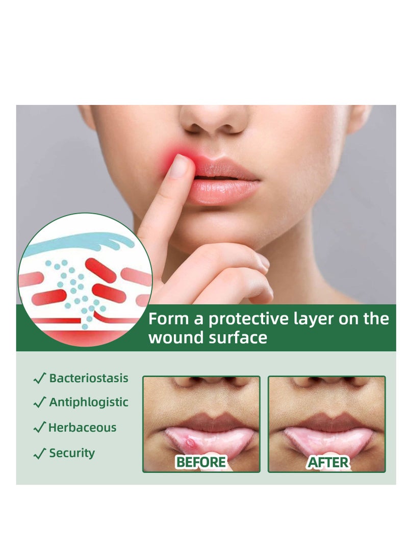 ساوث مون رذاذ قرحة الفم، رذاذ تخفيف قرحة الفم، علاج قرحة اللسان، رذاذ التنفس السيئ، علاج القرحة، معطر الفم، علاج قرحة الفم بالأعشاب، علاج فعال لقرحة الفم - Image 4
