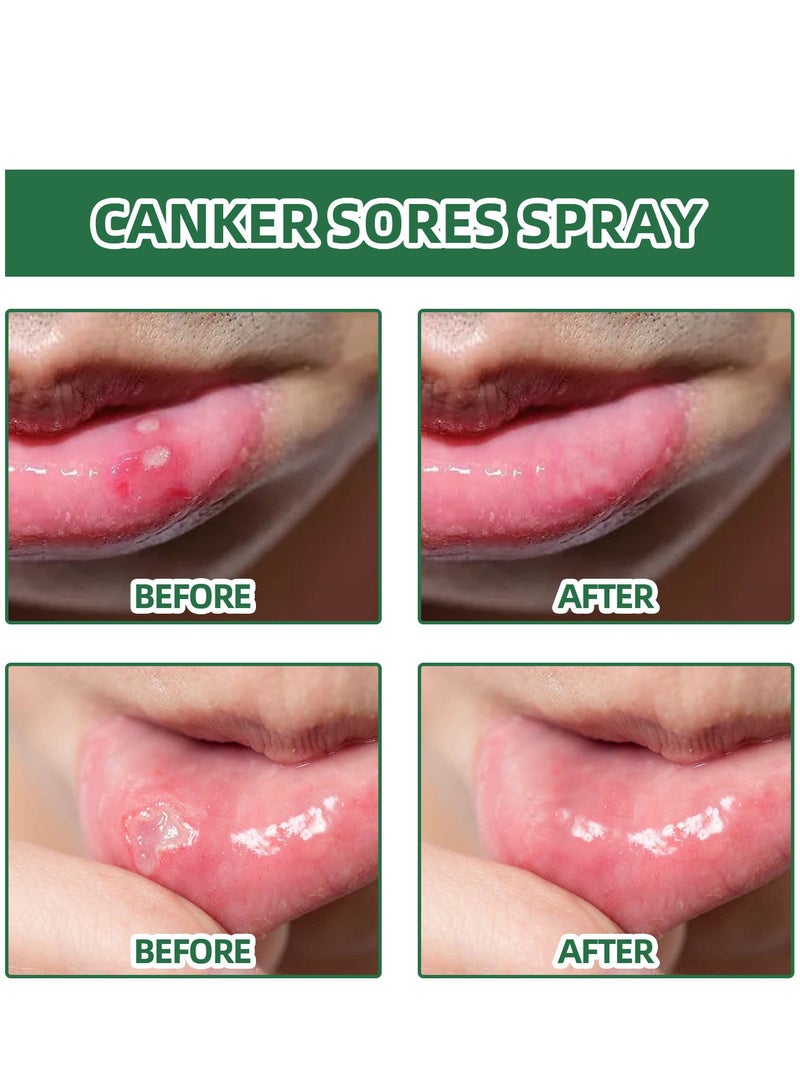 ساوث مون رذاذ قرحة الفم، رذاذ تخفيف قرحة الفم، علاج قرحة اللسان، رذاذ التنفس السيئ، علاج القرحة، معطر الفم، علاج قرحة الفم بالأعشاب، علاج فعال لقرحة الفم - Image 5