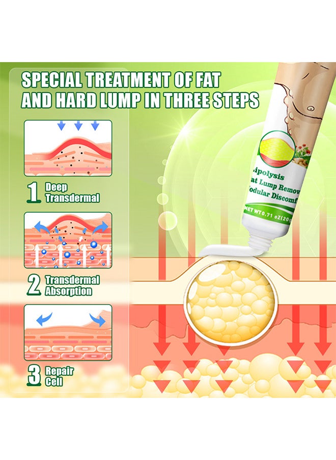 Sumifun - Lipoma Cream, GooLiving AntiHump Lymphcare Ginger Ointment, Underarm And Neck Lymphatic Care Cream, Lymphatic Drainage Cream, Anti-Cellulite Remover Cream - Image 1