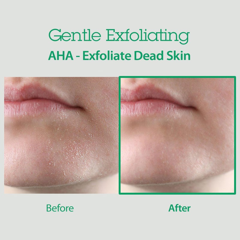 BLITHE AHA BHA Cleanser - Deep Pore Cleanser and Pore Minimizer, Exfoliant for Face, For Clogged Pores, 5.07 Fl Oz - Image 4