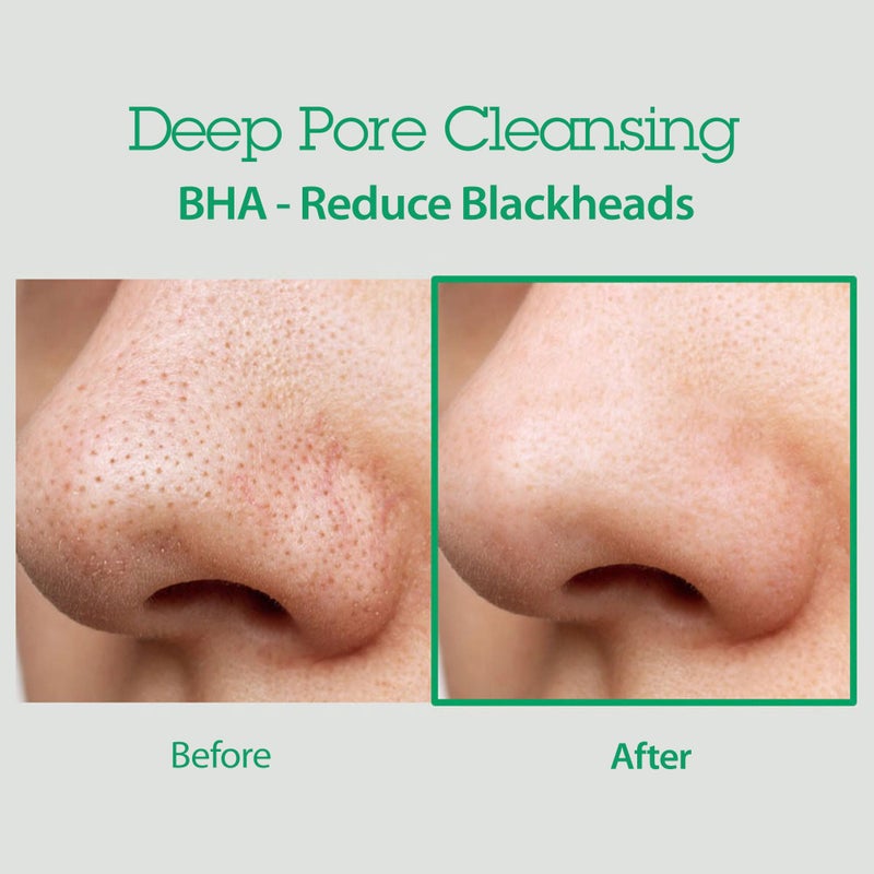 BLITHE AHA BHA Cleanser - Deep Pore Cleanser and Pore Minimizer, Exfoliant for Face, For Clogged Pores, 5.07 Fl Oz - Image 3