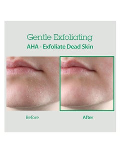 Blithe BLITHE AHA BHA Cleanser - Deep Pore Cleanser and Pore Minimizer, Exfoliant for Face, For Clogged Pores, 5.07 Fl Oz  - Image 2