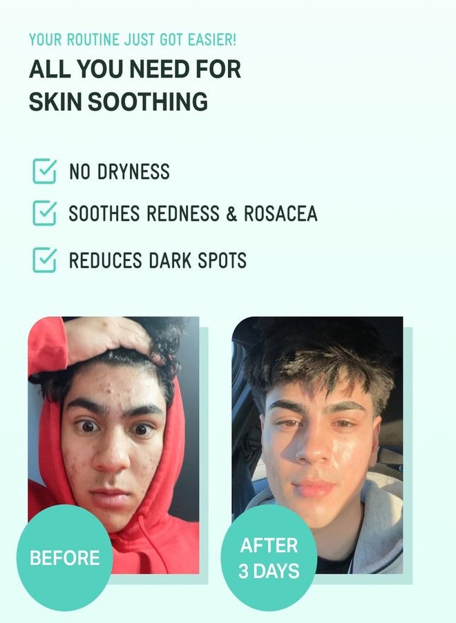 BRING GREEN سيروم زنك تيكا الأخضر مع النياسيناميد | سيروم مهدئ للوجه للبشرة الحساسة، يقلل المسام ويرطب | العناية بالبشرة الكورية للبثور وملمس غير متساوي - Image 5