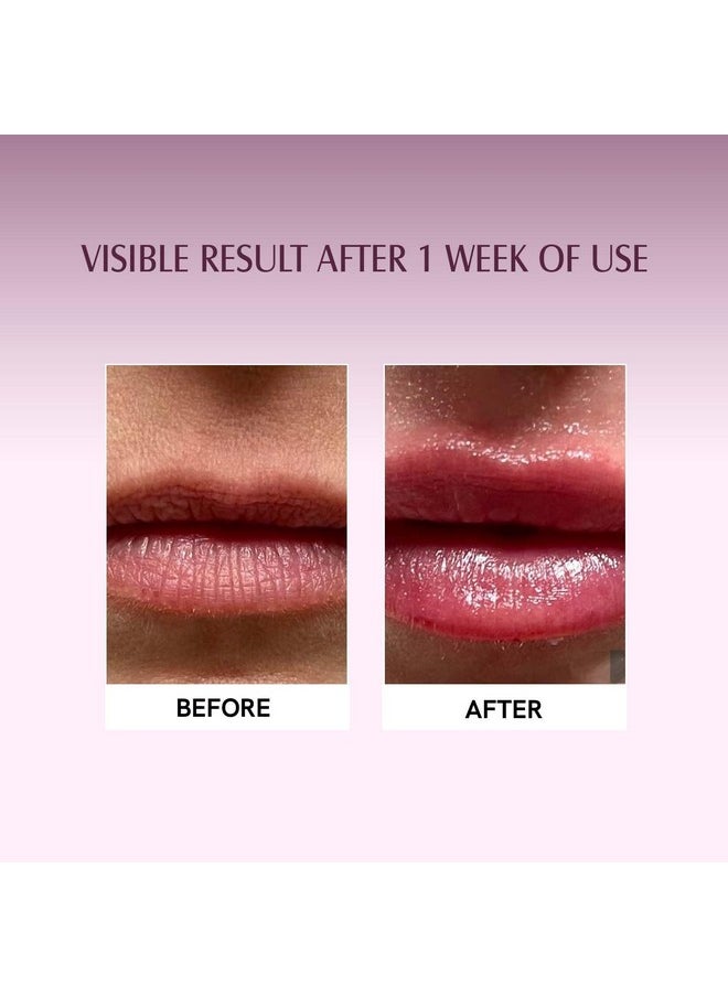 Aravi Organic - Beetroot Lip Balm With Beetroots, Shea Butter & Cocoa Butter - For Dry & Chapped Lips Lip - Protection & Nourishment - 8 Gm, Red - Image 1