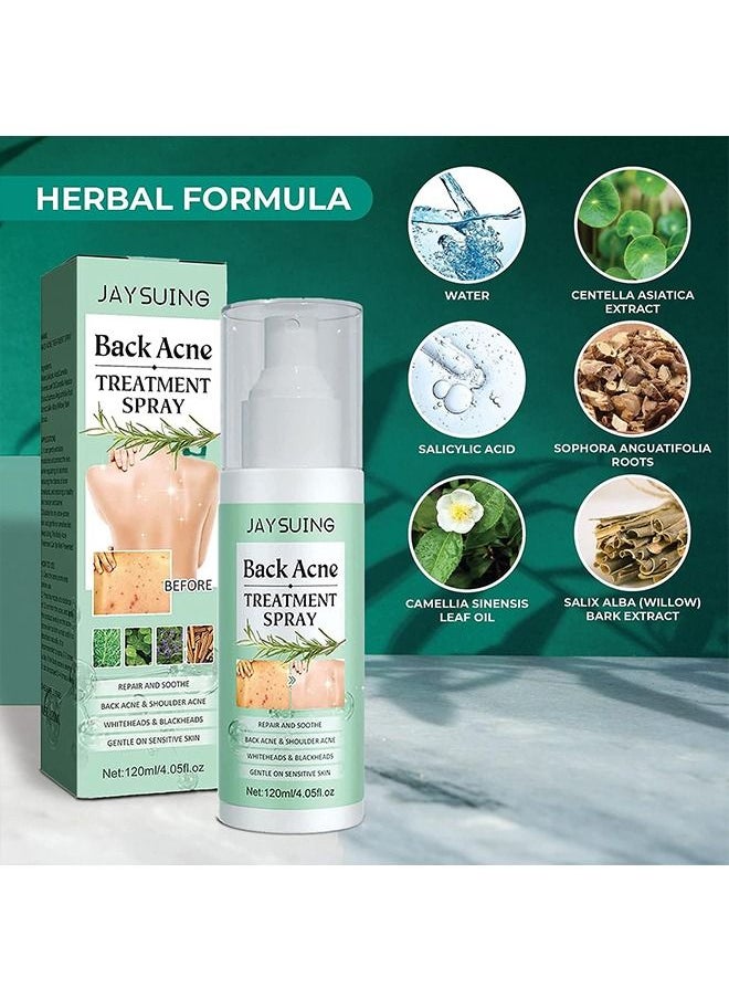 Jaysuing - 120ml Back Acne Treatment, Back Acne Spray, 2% Salicylic Acid Spray, Body Acne Treatment with Herbal Formula, Body Acne Spray, Tea Tree Oil Spray, Acne Treatment For Teens, Back Acne - Image 1