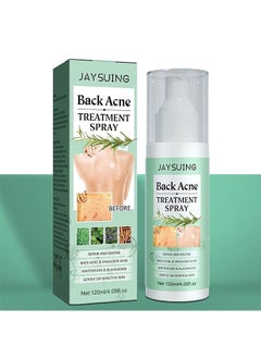 120ml Back Acne Treatment, Back Acne Spray, 2% Salicylic Acid Spray, Body Acne Treatment with Herbal Formula, Body Acne Spray, Tea Tree Oil Spray, Acne Treatment For Teens, Back Acne