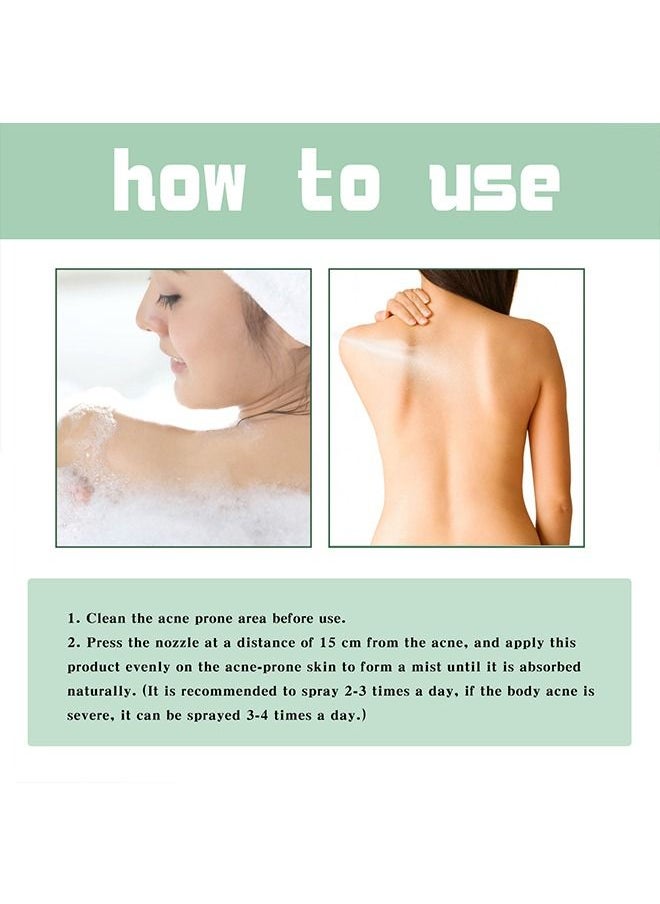Jaysuing - 120ml Back Acne Treatment, Back Acne Spray, 2% Salicylic Acid Spray, Body Acne Treatment with Herbal Formula, Body Acne Spray, Tea Tree Oil Spray, Acne Treatment For Teens, Back Acne - Image 1