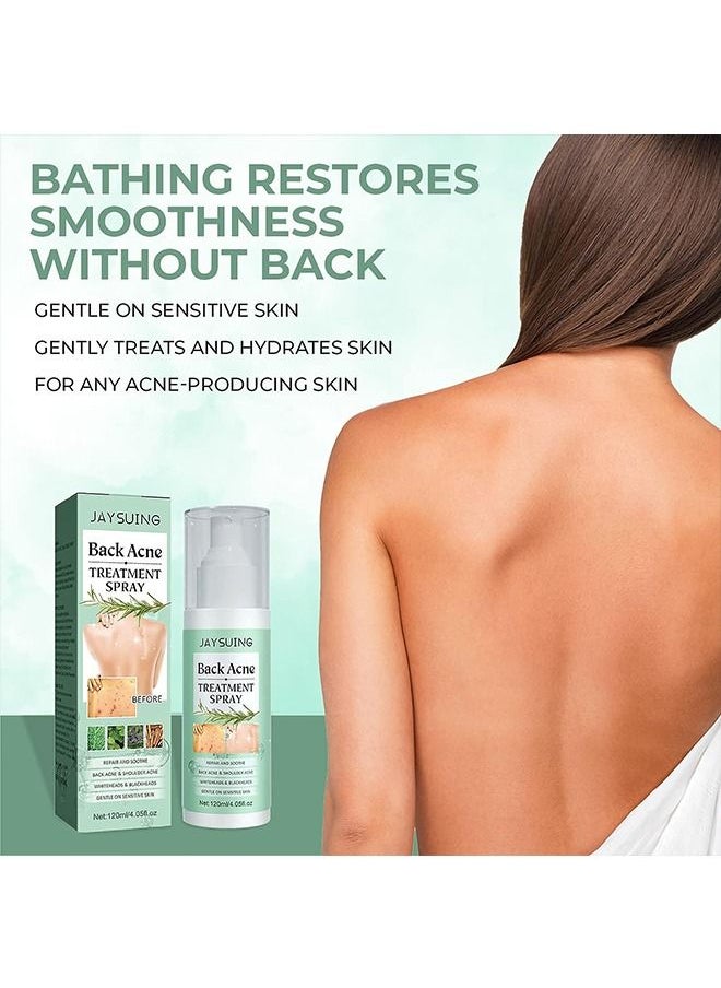 Jaysuing - 120ml Back Acne Treatment, Back Acne Spray, 2% Salicylic Acid Spray, Body Acne Treatment with Herbal Formula, Body Acne Spray, Tea Tree Oil Spray, Acne Treatment For Teens, Back Acne - Image 1