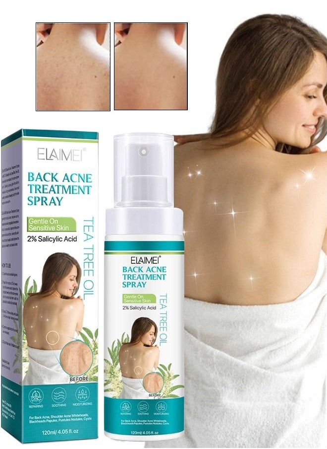 Elaimei 120ml Back Acne Treatment Spray 2% Salicylic Acid Body Acne Treatment with Herbal Formula Back Acne Spray Solution Tea Tree Oil Spray Soothing and Moisturizing Spray for Sensitive Skin  - Image 1