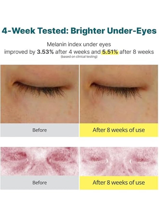 كريم جودال الأخضر باليوسفي وفيتامين سي للهالات السوداء حول العينين | علاج مكثف للهالات السوداء ومرونة البشرة، لطيف، غير مهيج، مضاد للشيخوخة والتجاعيد - Image 4