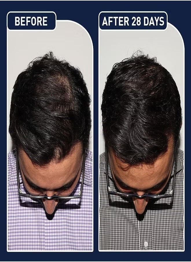 Kirkland Signature - Minoxidil 5% Extra Strength Hair Regrowth Treatment 60m - Image 1