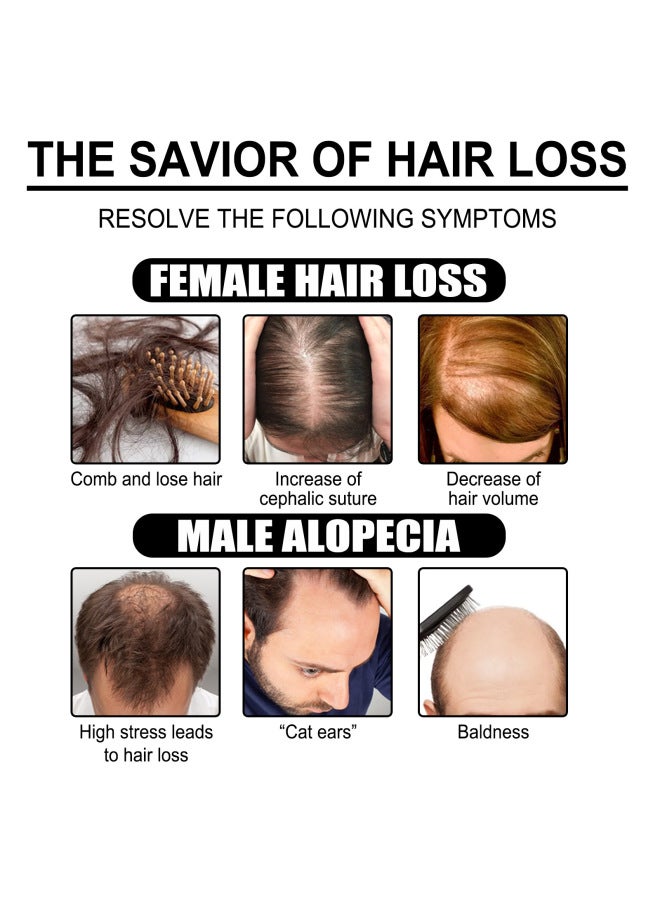 EELHOE Ginger Hair Care Essential Oil Mild Ingredients Moisturizing Hair Tail Soft Hair Ginger Essence Hair Care Oil - Image 2