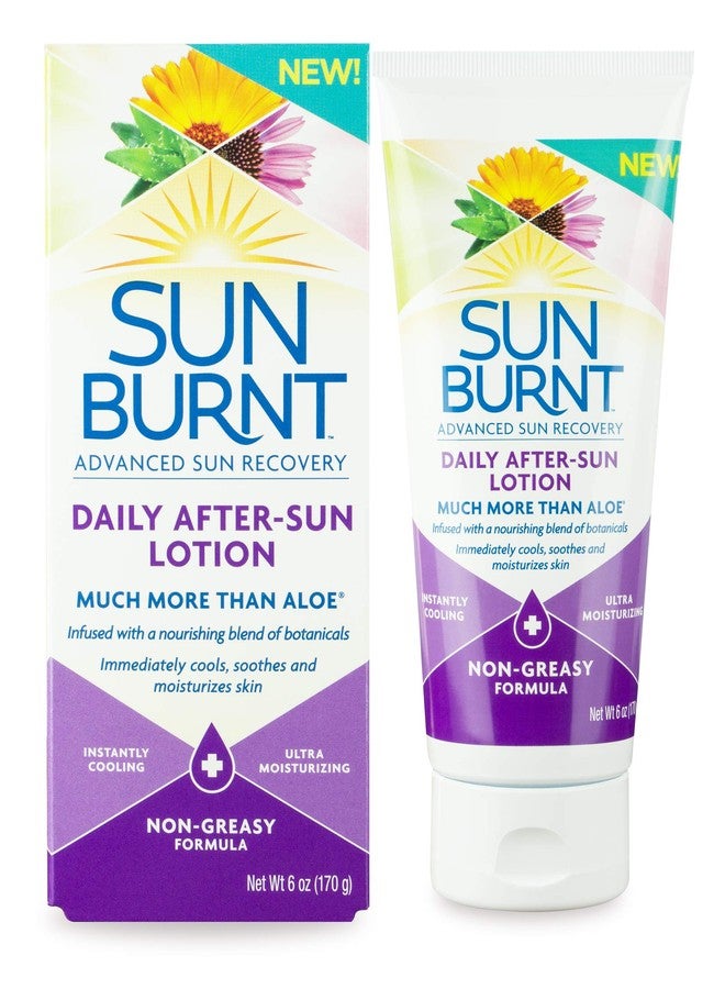 Sunburnt Advanced After-Sun Lotion, 6 Ounce - Image 1