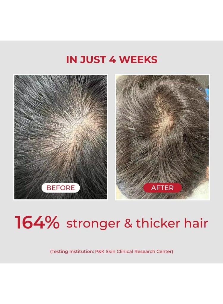 MOEV Hair Fall & Weak Roots Care – MOEV Annurcatin Strengthening Shampoo 300ml for Thinning Hair, Breakage & Weak Scalp Health - Image 5