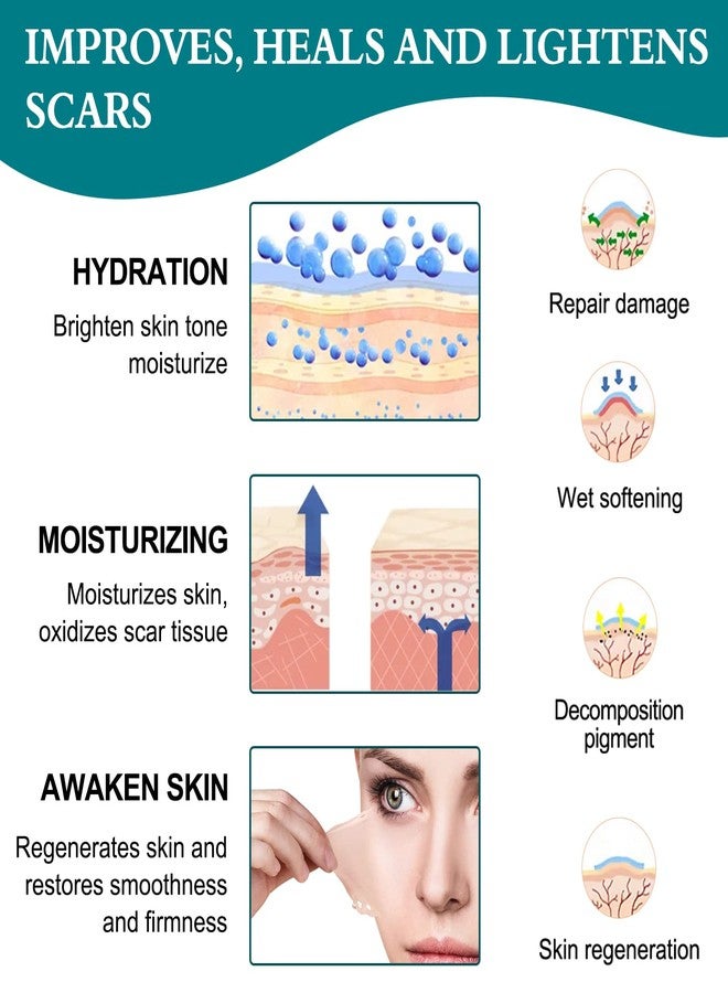 ZODENIS شرائح سيليكون لعلاج الندبات 16 قطعة، شرائط لاصقة للندبات، علاج الندبات الناتجة عن الجراحة، كيلود، عملية قيصرية، قابلة لإعادة الاستخدام، علاج الندبات، شرائح إزالة الندبات الاحترافية، كريم، جل، لاصق، ضمادات، وسادات. - Image 4