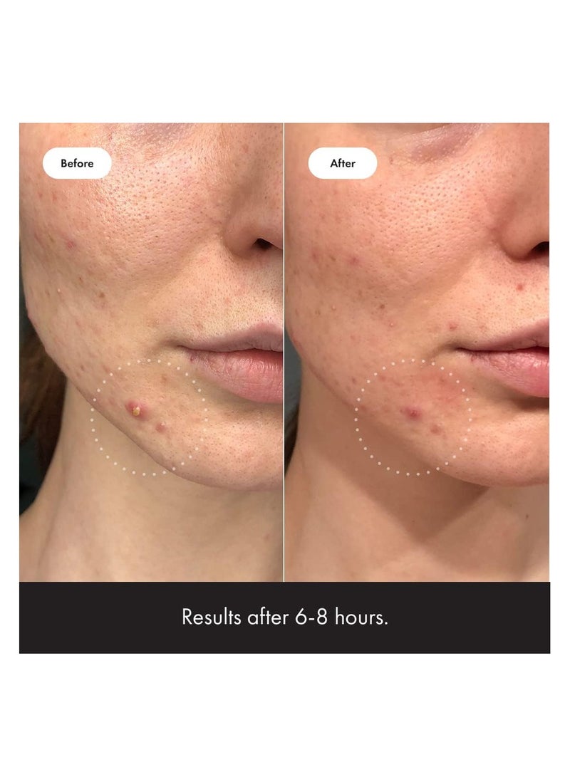 مايتي باتش مستحضرات التجميل البطل العظيمة ، غير مرئي+، 39 بقع - Image 4