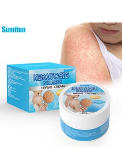 Keratosis Pilaris Repair Cream,Vitamin E cream, urea to remove dead skin cells 30g