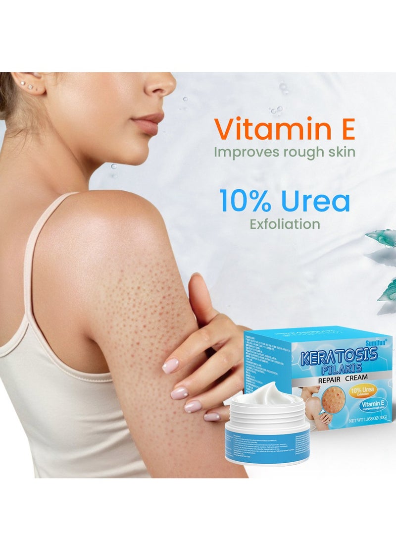 Sumifun - Keratosis Pilaris Repair Cream,Vitamin E cream, urea to remove dead skin cells 30g - Image 1