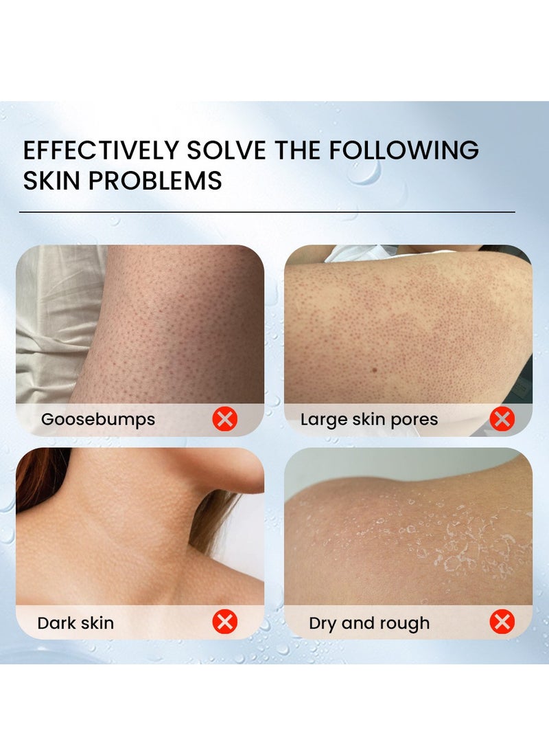 Sumifun - Keratosis Pilaris Repair Cream,Vitamin E cream, urea to remove dead skin cells 30g - Image 1