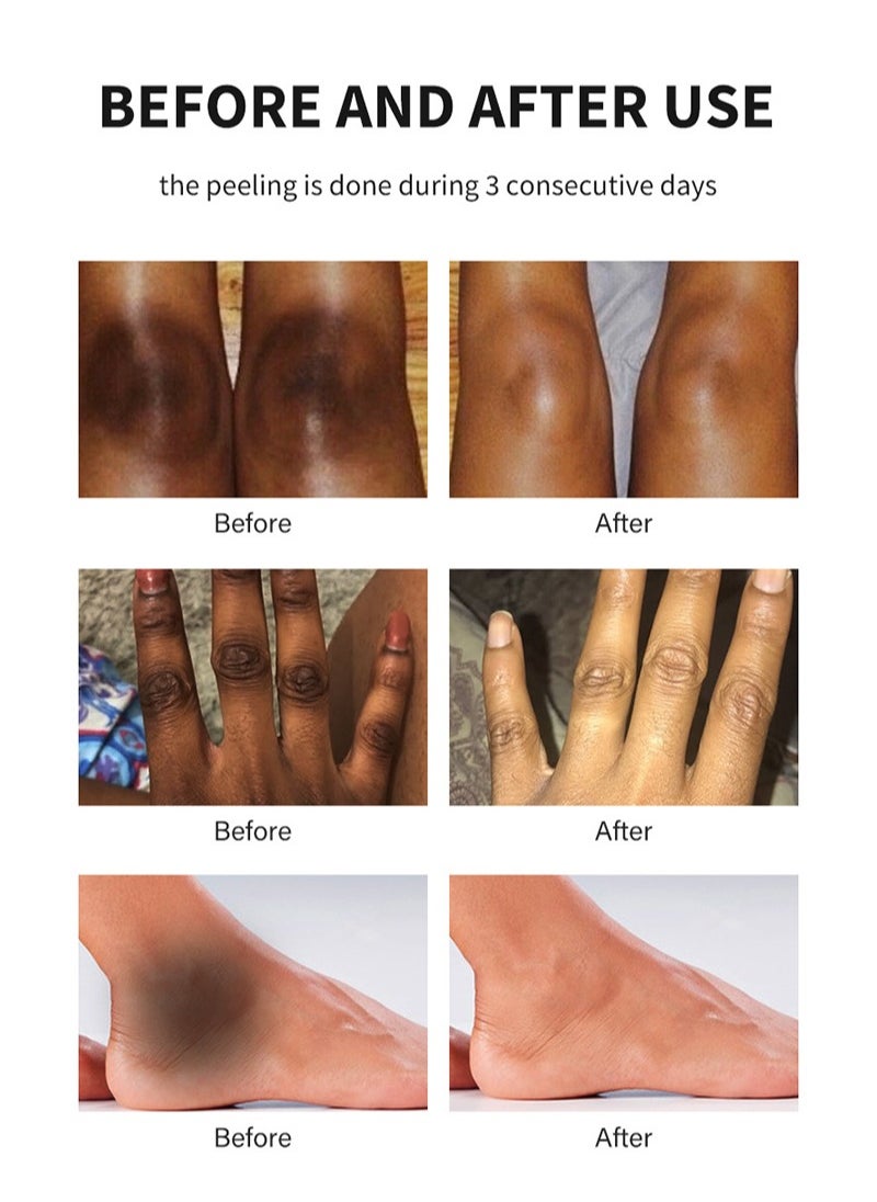 MOOYAM - Peeling Oil for Dark Skin,High Power Green Peeling Oil,Ultra Peeling Oil,Gentle Peeling Oil With Salicylic Acid,Exfoliating Oil for Hands and Feet Peeling,Solution Chemical Peeling for All Skin - Image 1