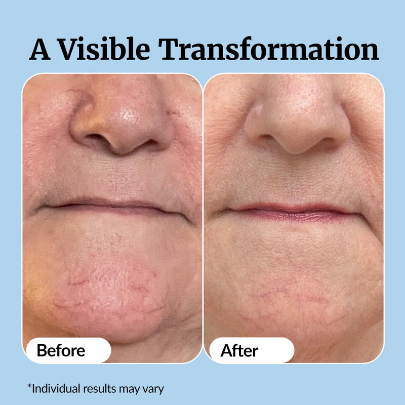 Vibriance Super C Serum for Mature Skin - All-in-One Vitamin Formula Hydrates, Firms, Lifts, Smooths, Targets Age Spots, Wrinkles, 1 fl oz - Pack of 2 - Image 5